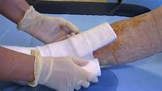 Dressings